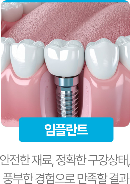 임플란트