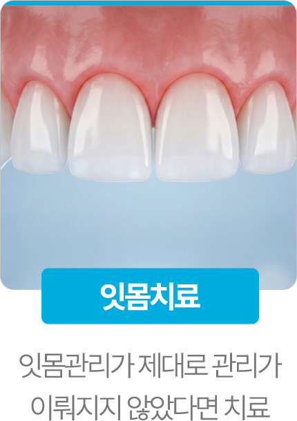 잇몸치료