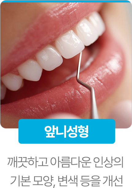 앞니성형