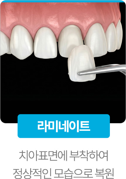 라미네이트