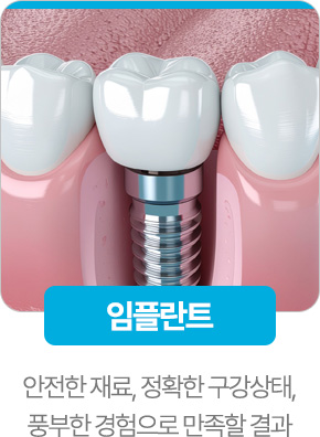 임플란트